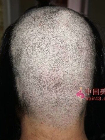 北方女孩在上海剃光头-Sephiroth119#