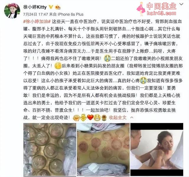 女明星全身溃烂去世，活着被当作家里的摇钱树，死了也要被当噱头