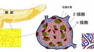 患上糖尿病后，这3种食物不妨多吃，你了解吗