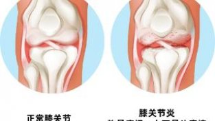 皮肤过敏简介