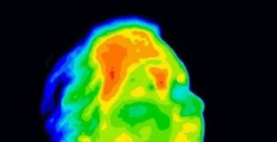 健康人脑日常可达40℃？想不到，“头脑发热”才是正常的……