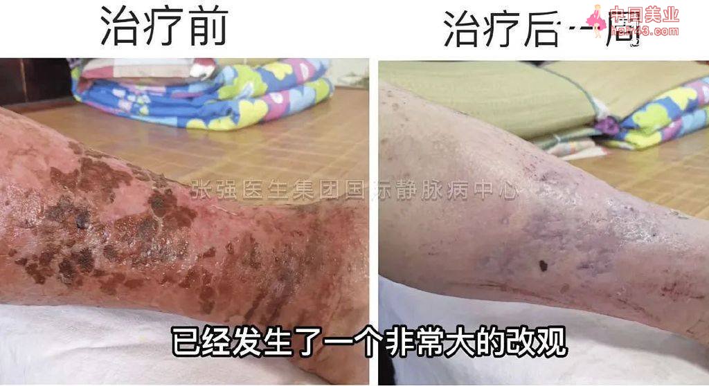 这样“吃油”，等于在悄悄地抗癌！