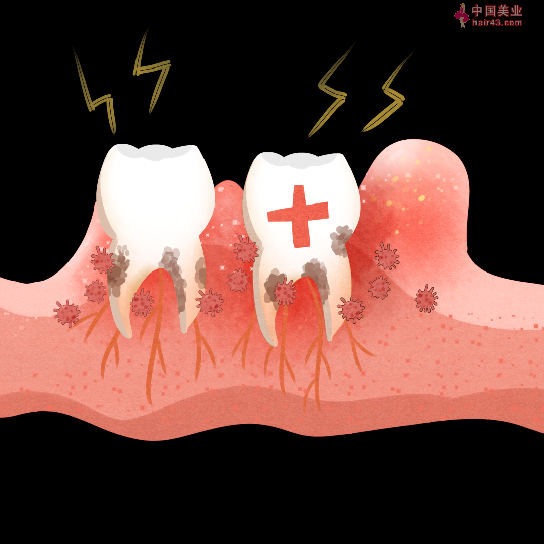 吃东西“总塞牙”是种病！不在意小心毁了你一口好牙