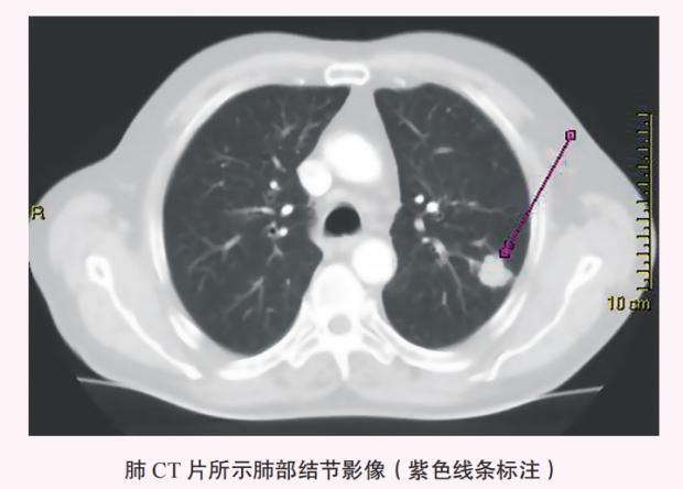 这种癌症发现时，大多已是晚期！其实身体早就给过你提示……