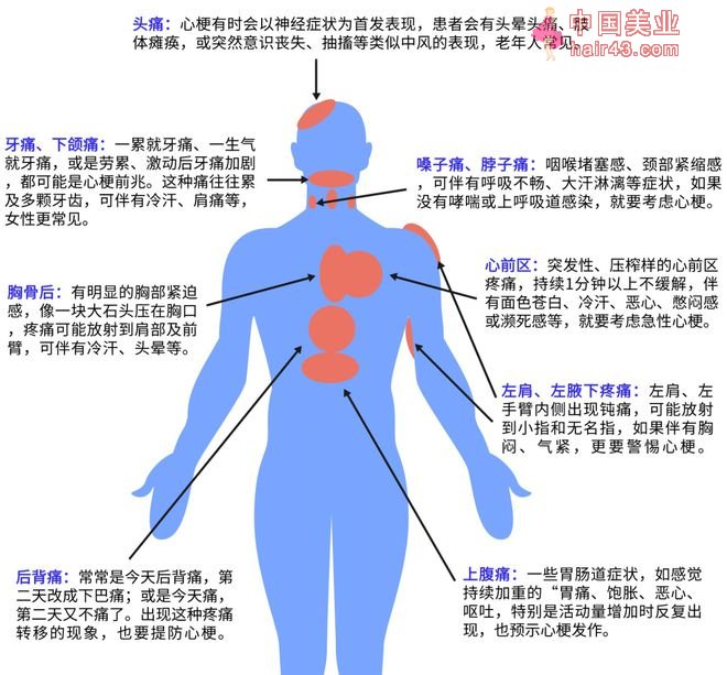 心梗猝死前，有3次救命机会！身体出现这8种痛，可能心脏出问题了