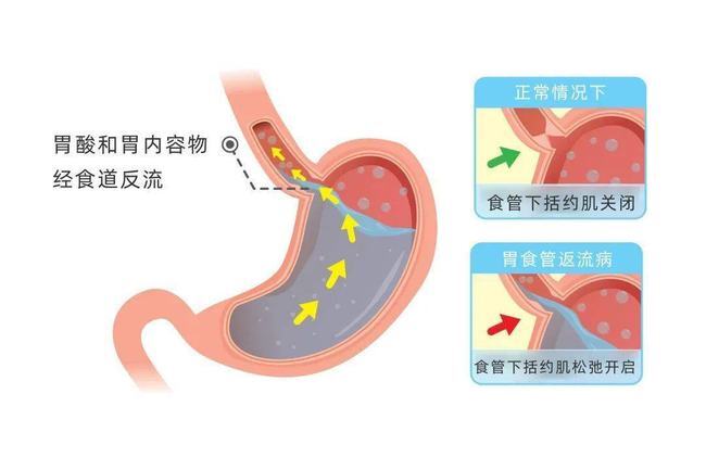 孩子白天不咳晚上咳，7大原因6个对策，照着做就对了