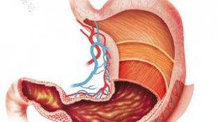 预防胃癌，日常养护胃部是关键，建议参考下