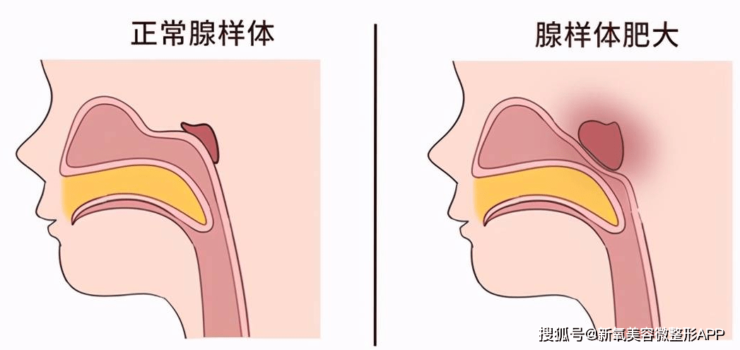 阿瑟塌房引发的口呼吸焦虑，原本就是个卖课的搞得野生理论…？